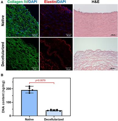 Enhancing decellularized vascular scaffolds with PVDF and PCL reinforcement: a fused deposition modeling approach